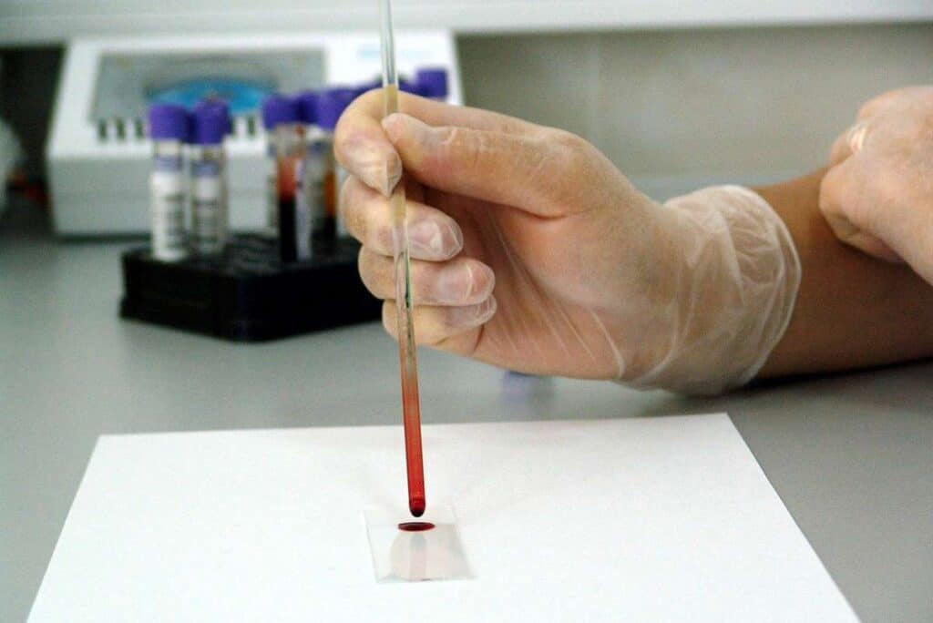 Mutaţia japoneză E484K a coronavirusului, depistată în România. Este extrem de periculoasă şi rezistentă la vaccin